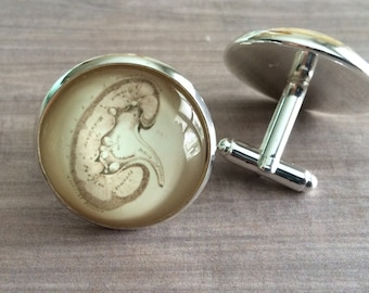 VINTAGE ANATOMY KIDNEY Cufflinks / The Kidney Cuff Links / Renal System / Gift for Him / Gift For G.U. Doctor nephrologist / gift boxed