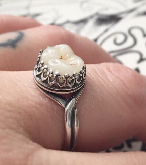 Tooth Ring