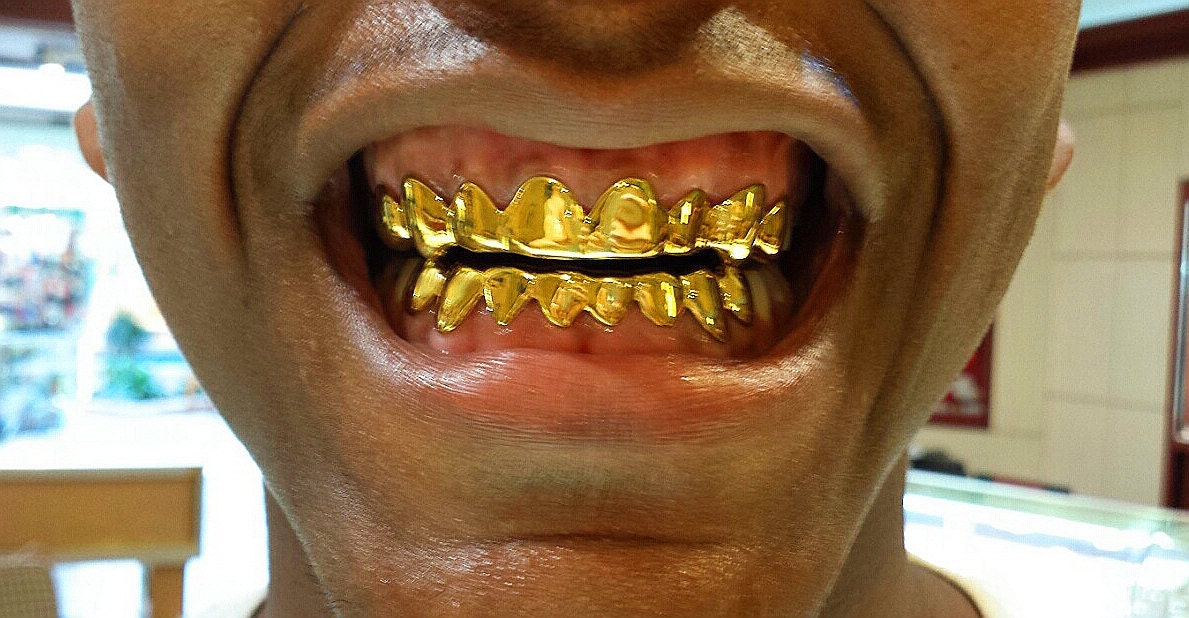 18K Solid Yellow Gold Custom Fit REAL Gold Grill Grillz Gold Teeth