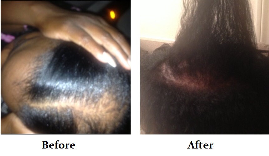 Formula D Hair Growth Serum, Amla, Bhringraj Coconut Oil ...