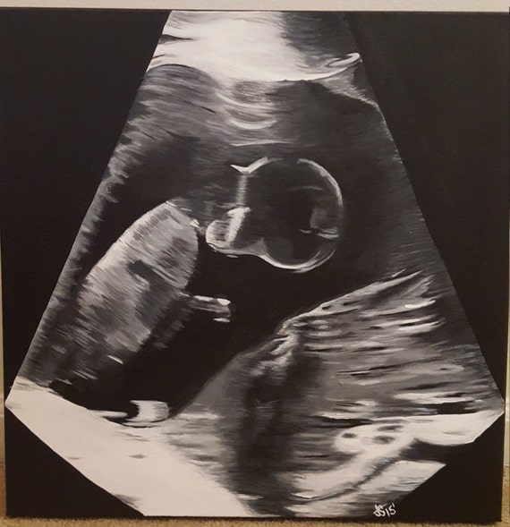 Custom ultrasound acrylic painting