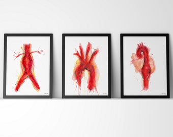 Cardiovascular Watercolor Art Print Set - Abdominal Aneurysm, Aorta and Thoracic Aneurysm Art Set - Anatomy Art Three Print Set
