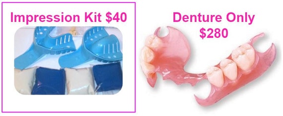 denture impression kit