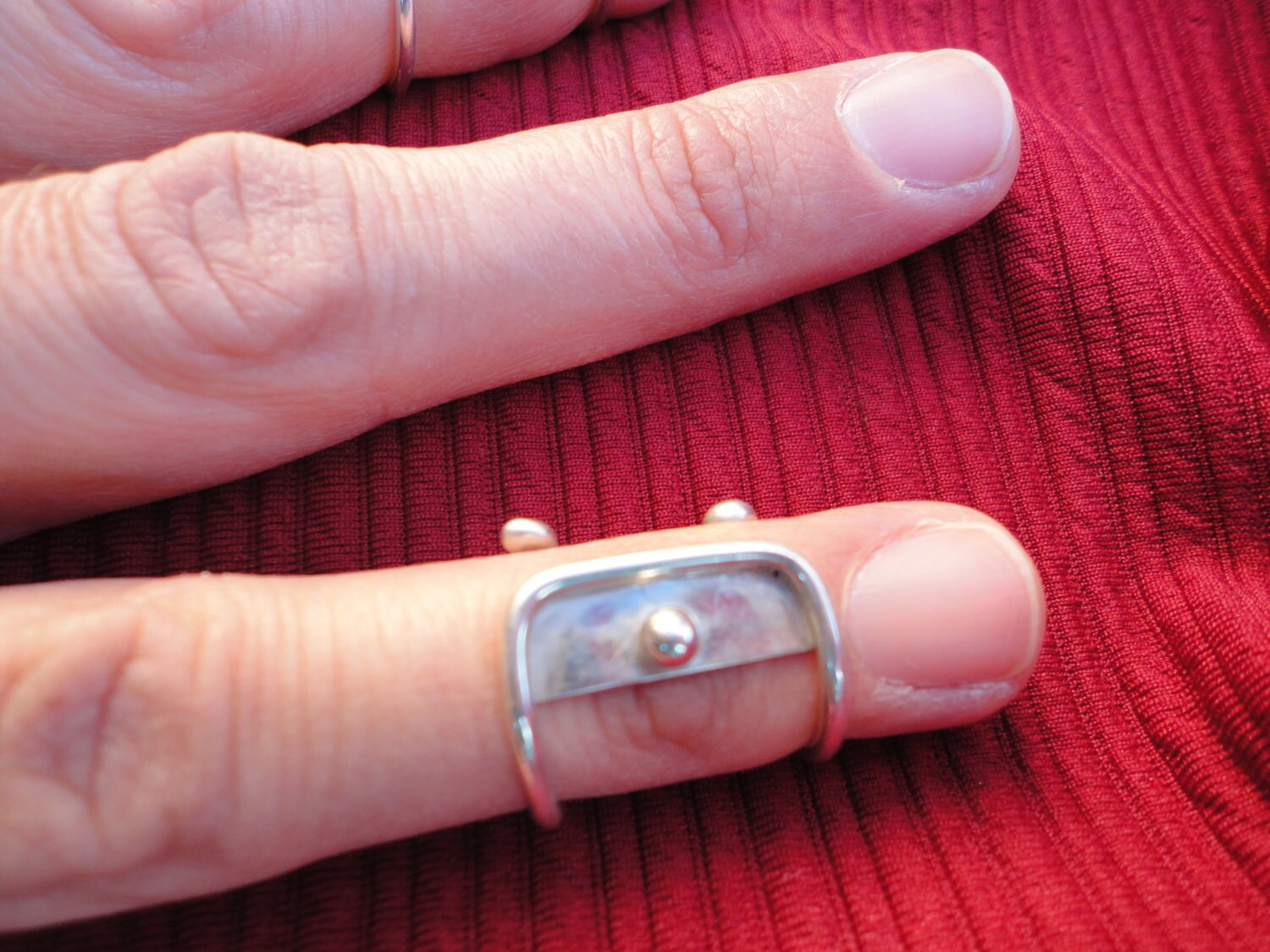 Silver splint ring