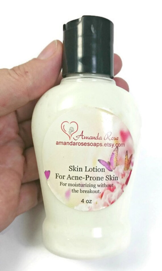 Moisturizing Lotion For AcneProne Skin by AmandaRoseSoaps on Etsy