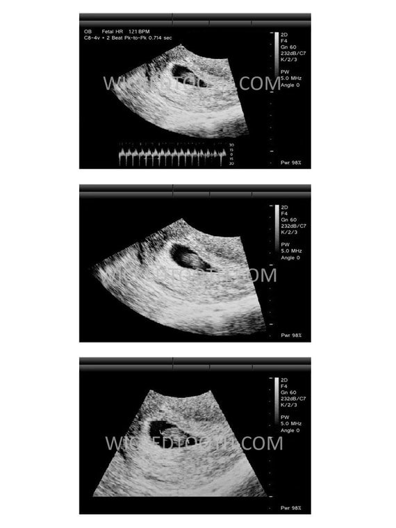 Ultrasound stripgag gift46 week ultrasoundgag gift for