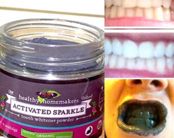 All Natural Whitening Teeth Powder - Organic Activated Charcoal Teeth Whitener - Remineralizing Tooth Whitening - Helps Prevent Tooth Decay