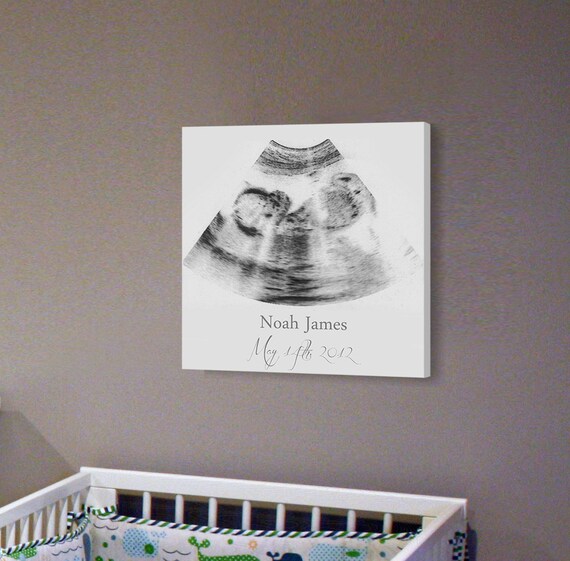 Sonogram Print Nursery Wall Art A Personalized by CanvasVows
