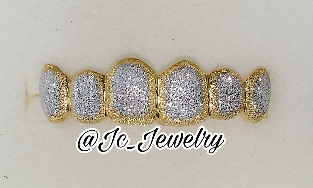Custom 14K Yellow Gold Grillz Plated FULL Diamond Dust Style