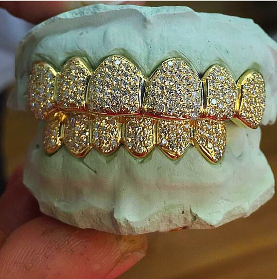 10k Diamond Grillz SI1VVS1 Diamond Teeth