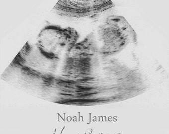 Sonogram Print, Nursery Wall Art, A Personalized Ultrasound Canvas Frame, Ultrasound Wall Decor