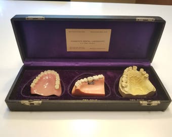 Dental travel models/molds