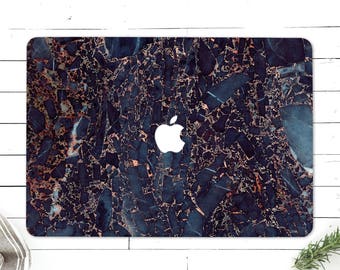 MacBook Case MacBook Pro Case MacBook Air Case Macbook Pro 13 Case Macbook Pro 15 Case Macbook Air 11 Case Marble Macbook Pro Retina 26