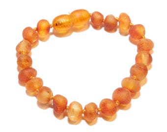 Genuine RAW Baltic Amber Baby Teething Bracelet Anklet Dark Honey. Authentic 14 - 15 cm/5.5 - 5.9 in RA2